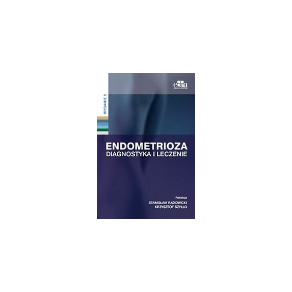 Endometrioza Diagnostyka i leczenie