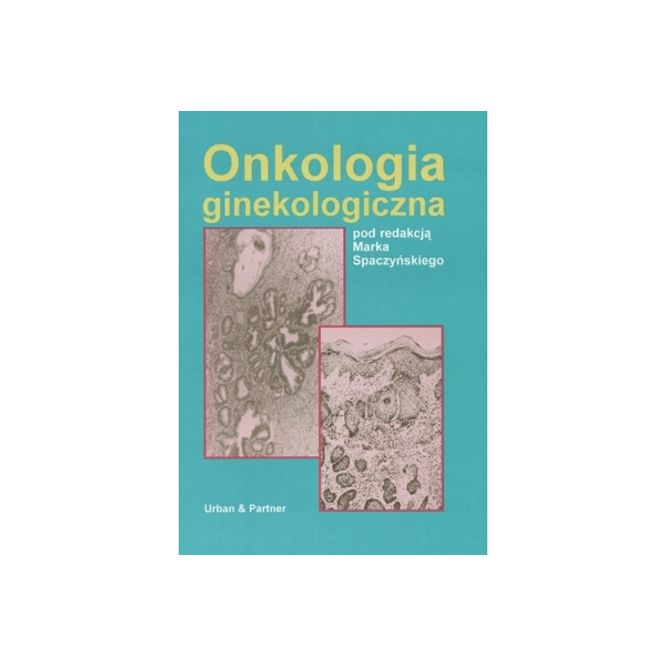 Onkologia ginekologiczna