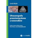 Ultrasonografia przezciemiączkowa u noworodków