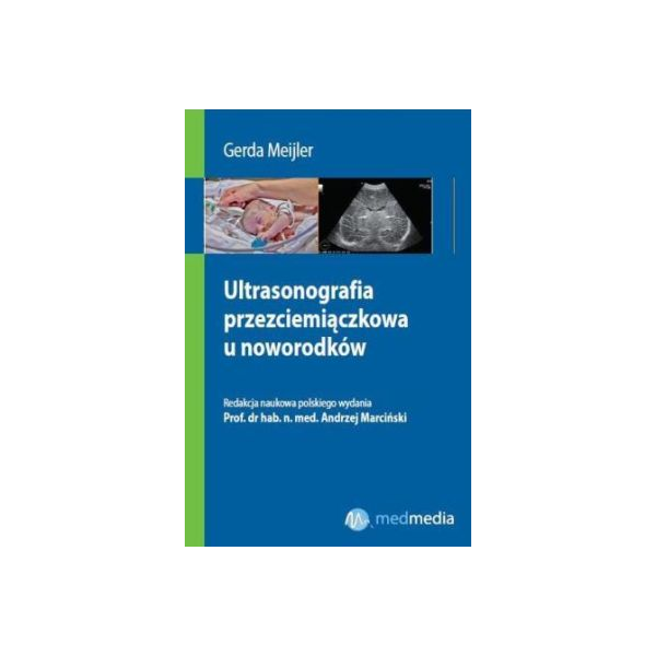 Ultrasonografia przezciemiączkowa u noworodków