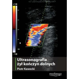 Ultrasonografia żył kończyn dolnych