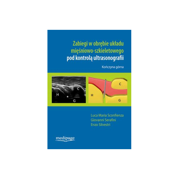 Zabiegi w obrębie układu mięśniowo-szkieletowego pod kontrolą ultrasonografii Kończyna górna