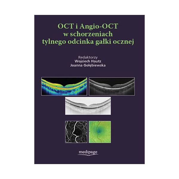 OCT i Angio-OCT w schorzeniach tylnego odcinka gałki ocznej