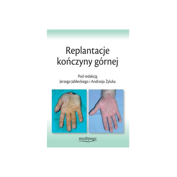 Replantacje kończyny górnej