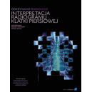 Odkrywanie radiologii: interpretacja radiogramu klatki piersiowej
