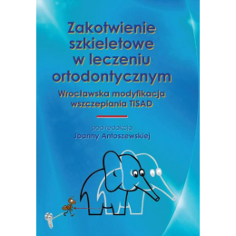 Zakotwienie szkieletowe w leczeniu ortodontycznym Wrocławska modyfikacja wszczepiania TISAD