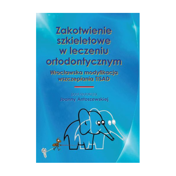 Zakotwienie szkieletowe w leczeniu ortodontycznym Wrocławska modyfikacja wszczepiania TISAD