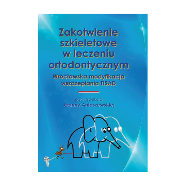 Zakotwienie szkieletowe w leczeniu ortodontycznym Wrocławska modyfikacja wszczepiania TISAD Zakotwienie szkieletowe w leczeniu ortodontycznym Wrocławska modyfikacja wszczepiania TISAD