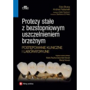 Protezy stałe z bezstopniowym uszczelnieniem brzeżnym