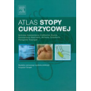 Atlas stopy cukrzycowej