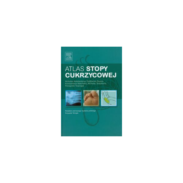 Atlas stopy cukrzycowej