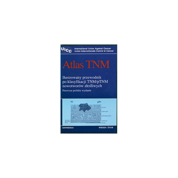 Atlas TNM Ilustrowany przewodnik po klasyfikacji TNM/pTNM nowotworów złośliwych