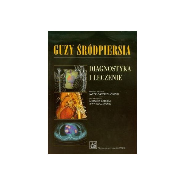 Guzy śródpiersia Diagnostyka i leczenie