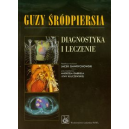 Guzy śródpiersia Diagnostyka i leczenie