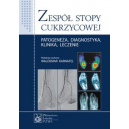 Zespół stopy cukrzycowej Patogeneza, diagnostyka, klinika, leczenie