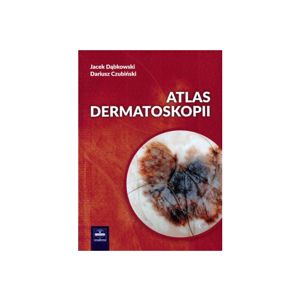 Atlas dermatoskopii Atlas dermatoskopii