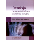 Remisja w reumatoidalnym zapaleniu stawów