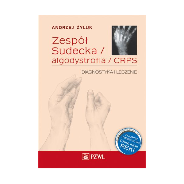 Zespół Sudecka / Algodystrofia / CRPS Diagnostyka i leczenie