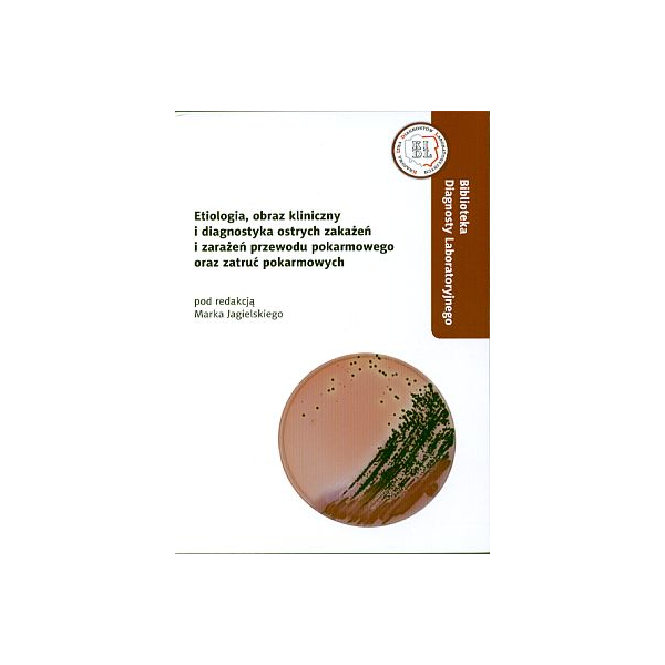 Etiologia, obraz kliniczny i diagnostyka ostrych zakażeń i zarażeń przewodu pokarmowego oraz zatruć pokarmowych (z CD)