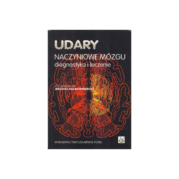 Udary naczyniowe mózgu Diagnostyka i leczenie