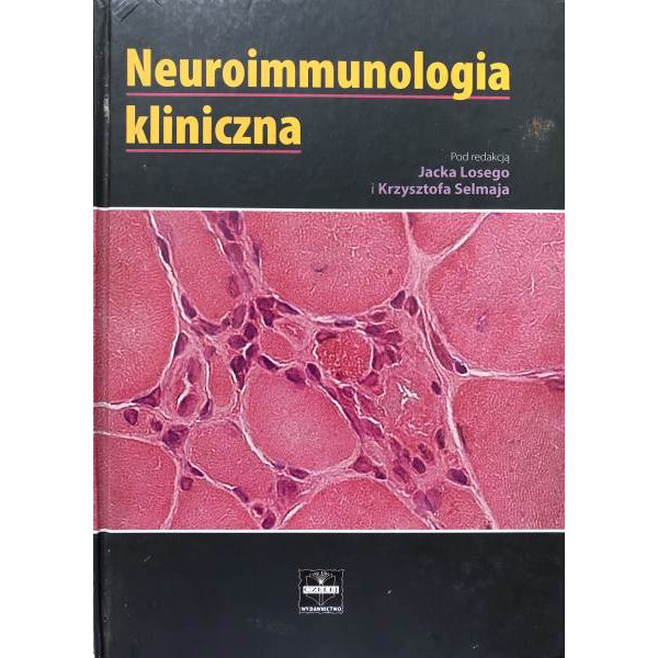 Neuroimmunologia kliniczna