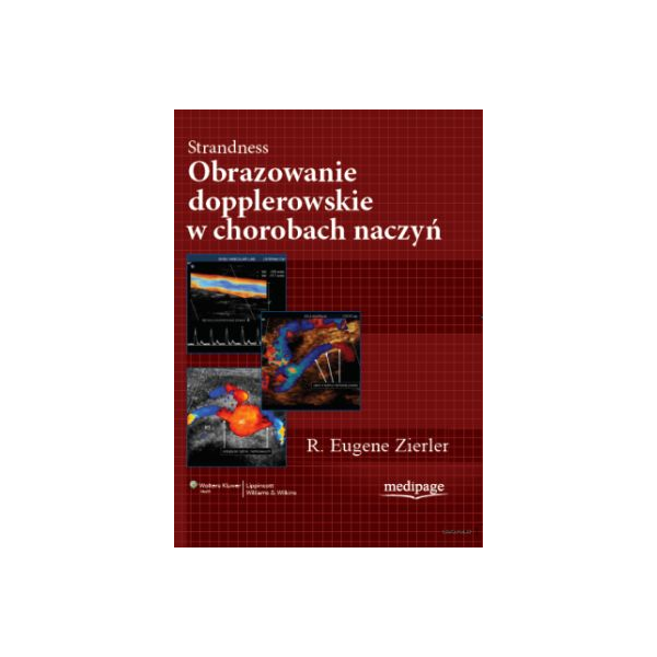 Strandness Obrazowanie dopplerowskie w chorobach naczyń