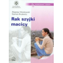 Rak szyjki macicy