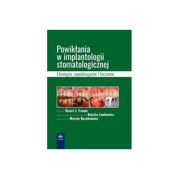 Powikłania w implantologii stomatologicznej Etiologia zapobieganie leczenie