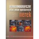 Ultrasonograficzny atlas zmian ogniskowych nerek