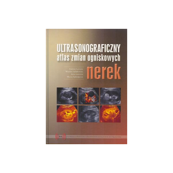 Ultrasonograficzny atlas zmian ogniskowych nerek