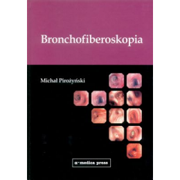 Bronchofiberoskopia