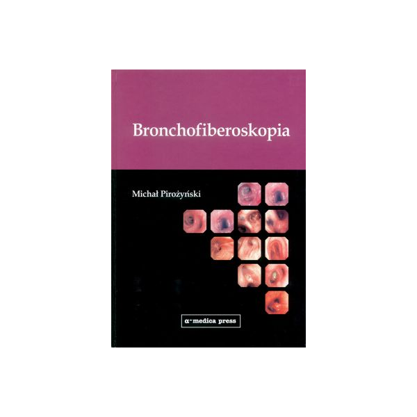 Bronchofiberoskopia