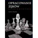 Opracowanie zębów Wiedza i sztuka