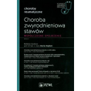 Choroba zwyrodnieniowa stawów Współczesne sojrzenie