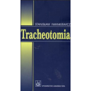 Tracheotomia