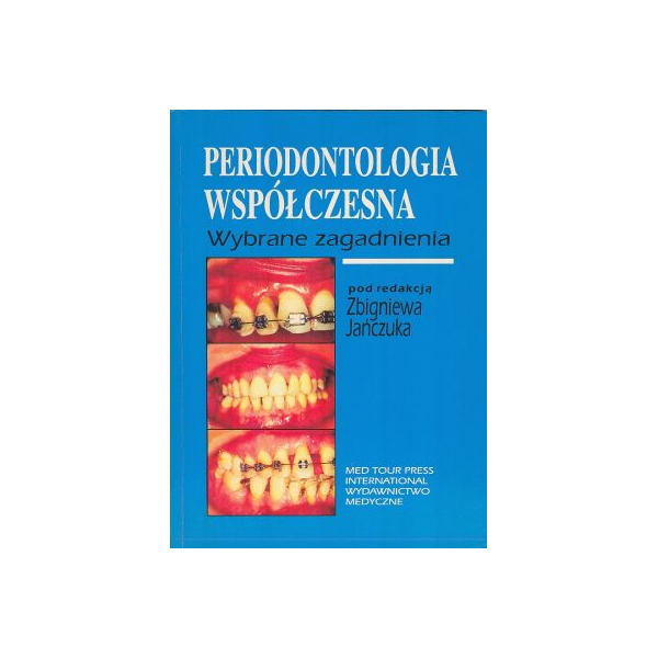 Periodontologia współczesna wybrane zagadnienia