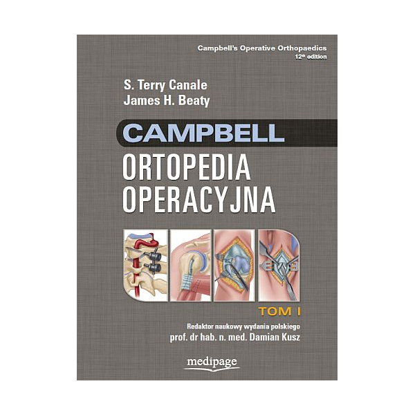 Ortopedia operacyjna Campbell t. 1