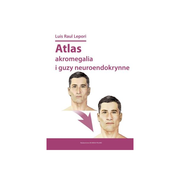 Atlas akromegalia i guzy neuroendokrynne