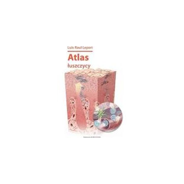 Atlas łuszczycy