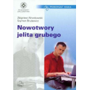 Nowotwory jelita grubego