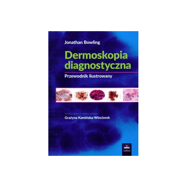 Dermoskopia diagnostyczna Przewodnik ilustrowany