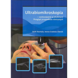 Ultrabiomikroskopia - zastosowanie w okulistyce Przegląd przypadków klinicznych