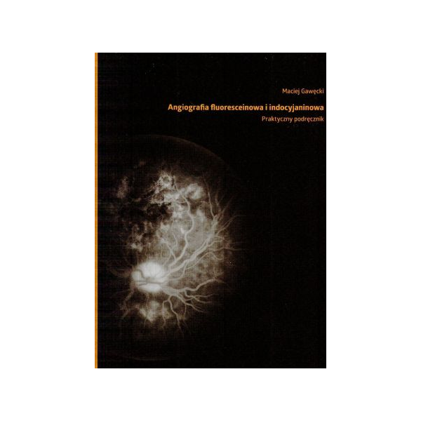 Angiografia fluoresceinowa i i indocyjaninowa
 Praktyczny podręcznik
