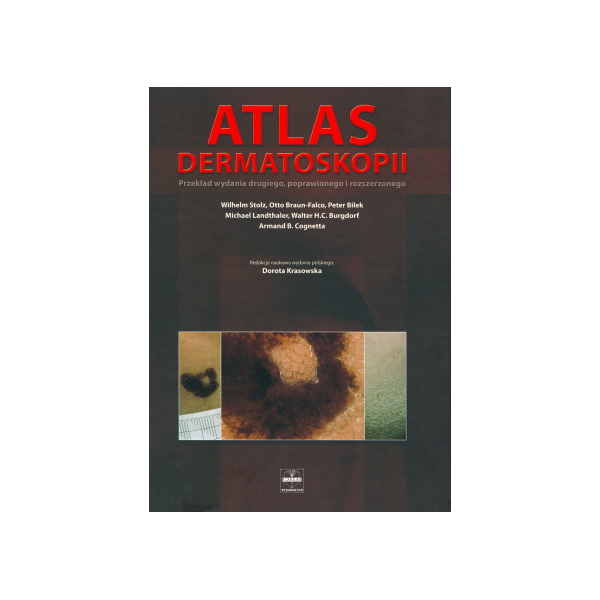 Atlas dermatoskopii