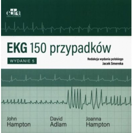 EKG 150 przypadków