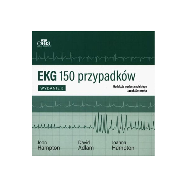 EKG 150 przypadków