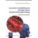 Leczenie trombolityczne ostrego udaru niedokrwiennego mózgu 
Od teorii do praktyki