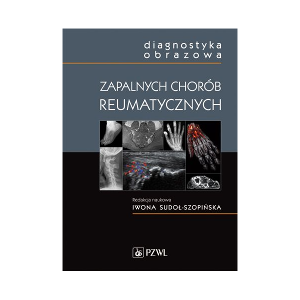 Diagnostyka obrazowa zapalnych chorób reumatycznych