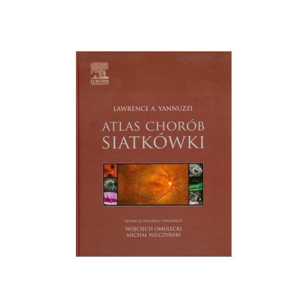 Atlas chorób siatkówki 