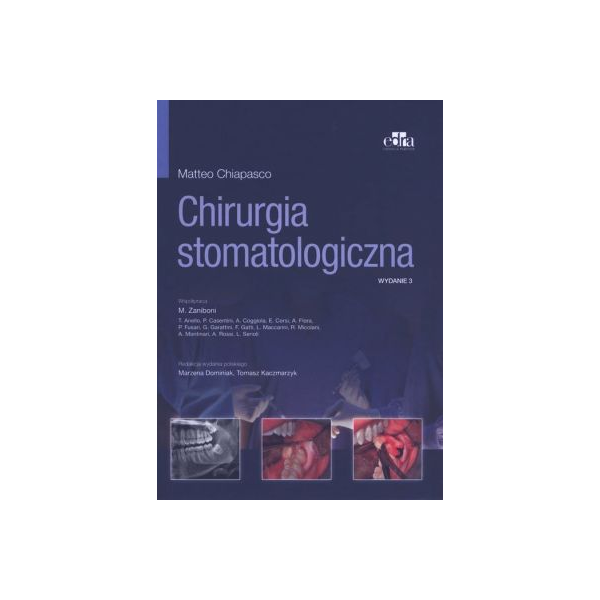 Chirurgia stomatologiczna 